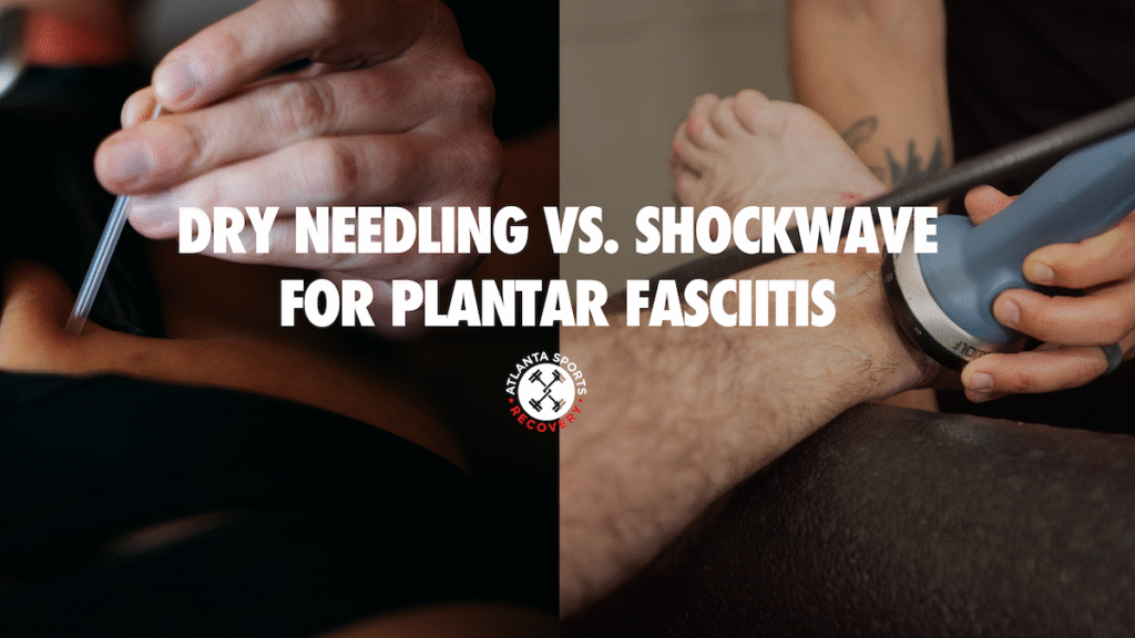 Shockwave vs. Dry Needling for Plantar Fasciitis